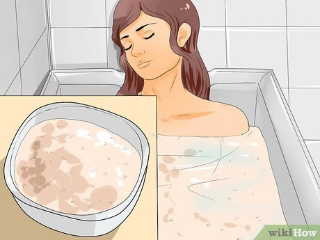 how to turn sunburn into a tan 12 steps